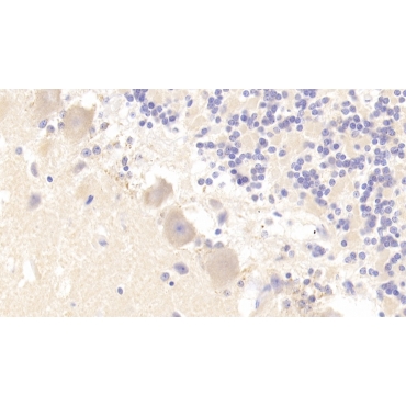 Breakpoint Cluster Region (BCR) Human Polyclonal Antibody