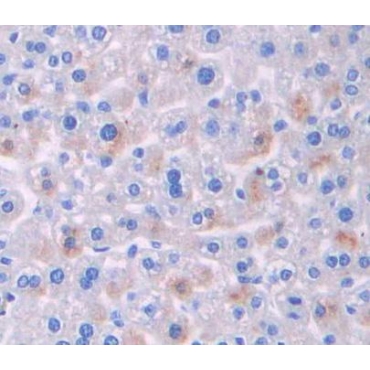 Breakpoint Cluster Region (BCR) Mouse Polyclonal Antibody