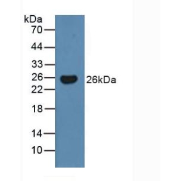 Bcl2 Modifying Factor (BMF) Human Polyclonal Antibody