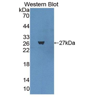 Basonuclin 1 (BNC1) Human Polyclonal Antibody