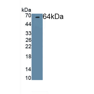 Brain Specific Angiogenesis Inhibitor 1 (BAI1) Human Polyclonal Antibody