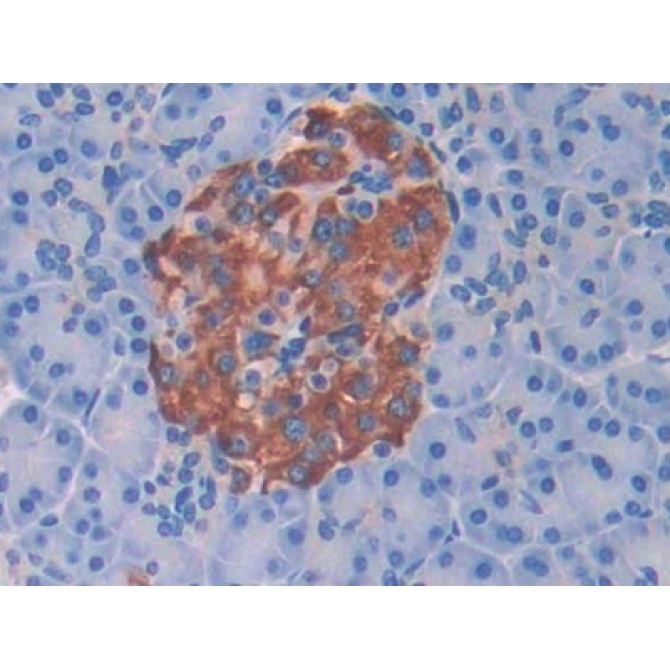 Butyrylcholinesterase (BCHE) Human Polyclonal Antibody