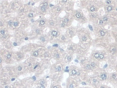 Butyrylcholinesterase (BCHE) Rat Polyclonal Antibody