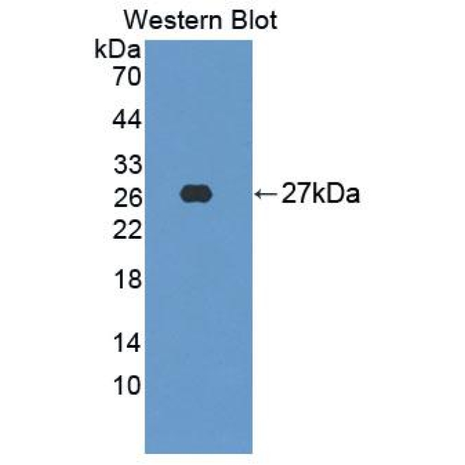 C-Src Tyrosine Kinase (CSK) Human Polyclonal Antibody