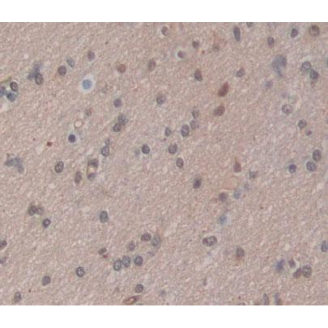 Calcineurin Binding Protein 1 (CABIN1) Human Polyclonal Antibody