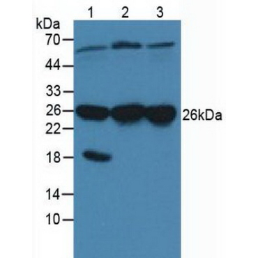 Calcyclin Binding Protein (CACYBP) Human Polyclonal Antibody