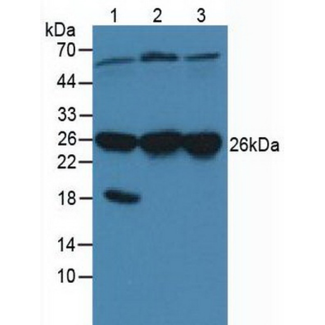 Calcyclin Binding Protein (CACYBP) Human Polyclonal Antibody