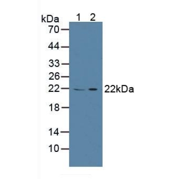 Calcyphosine (CAPS) Human Polyclonal Antibody