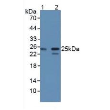 Core Binding Factor Beta Subunit (CBFb) Human Polyclonal Antibody