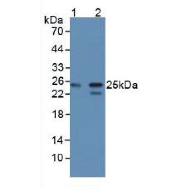 Core Binding Factor Beta Subunit (CBFb) Human Polyclonal Antibody