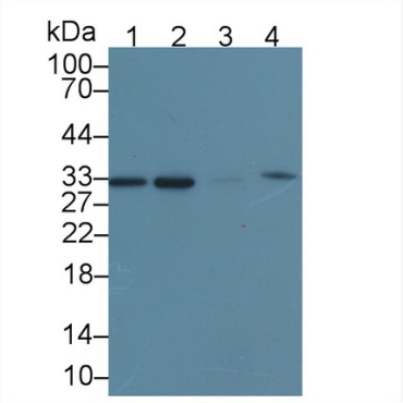 Carbonyl Reductase 1 (CBR1) Human Polyclonal Antibody