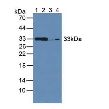Carbonyl Reductase 1 (CBR1) Mouse Polyclonal Antibody