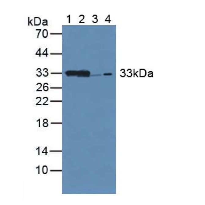 Carbonyl Reductase 1 (CBR1) Mouse Polyclonal Antibody