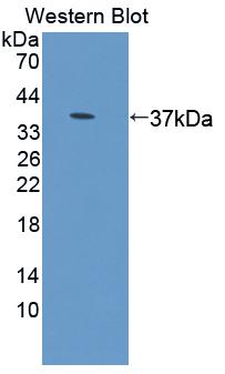 Carbonyl Reductase 1 (CBR1) Rat Polyclonal Antibody