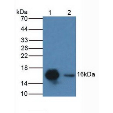 Cytidine Deaminase (CDA) Human Polyclonal Antibody