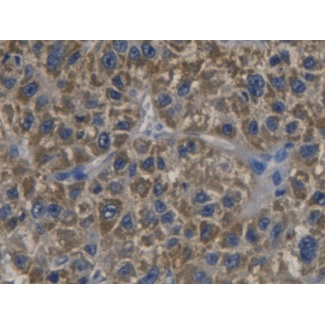 Cyclin Dependent Kinase Inhibitor 3 (CDKN3) Human Polyclonal Antibody