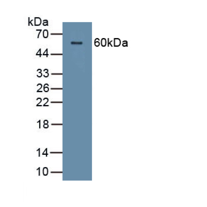 Corneodesmosin (CDSN) Human Polyclonal Antibody