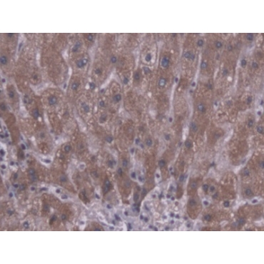 Carboxylesterase 1 (CES1) Human Polyclonal Antibody