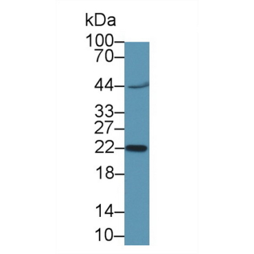 Chorionic Gonadotropin Beta Polypeptide 1 (CGb1) Human Polyclonal Antibody