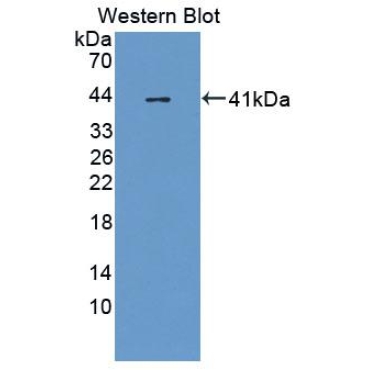 Chorionic Gonadotropin Beta Polypeptide 1 (CGb1) Human Polyclonal Antibody