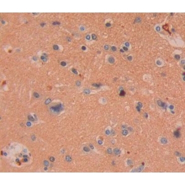 Chondrolectin (CHODL) Human Polyclonal Antibody