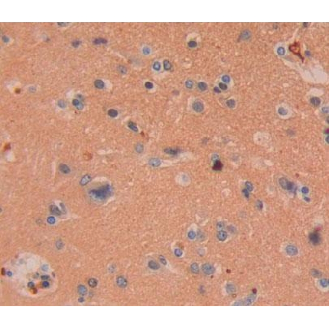 Chondrolectin (CHODL) Human Polyclonal Antibody