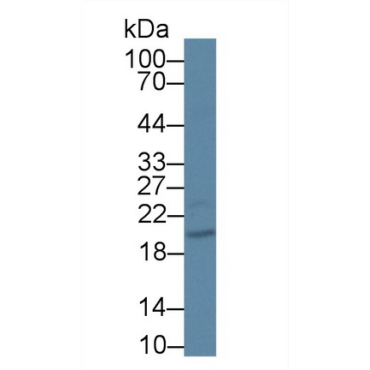 Calcium And Integrin Binding Protein 1 (CIB1) Human Polyclonal Antibody