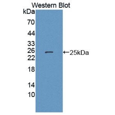 Cytokine Inducible SH2 Containing Protein (CISH) Mouse Polyclonal Antibody