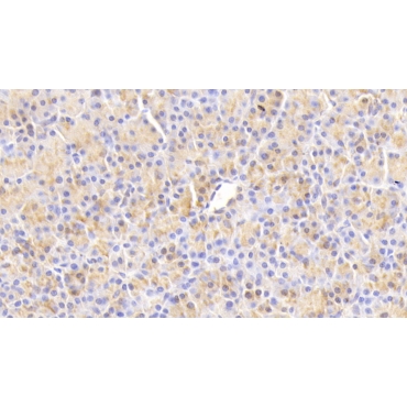 Chemokine Like Factor (CKLF) Human Polyclonal Antibody