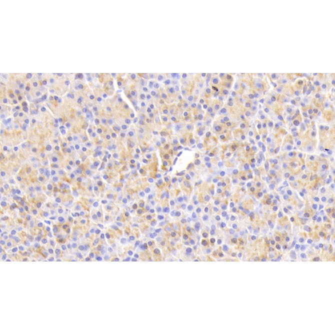 Chemokine Like Factor (CKLF) Human Polyclonal Antibody