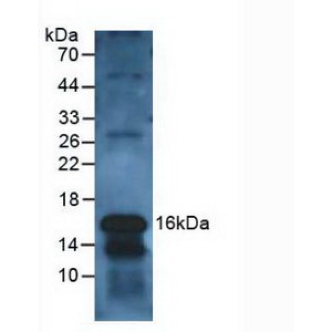 Charcot Leyden Crystal Protein (CLC) Human Polyclonal Antibody