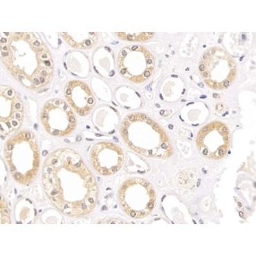 Claudin 1 (CLDN1) Human Polyclonal Antibody