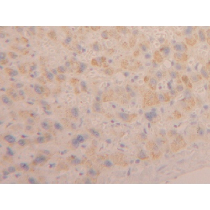 Cardiotrophin Like Cytokine Factor 1 (CLCF1) Human Polyclonal Antibody
