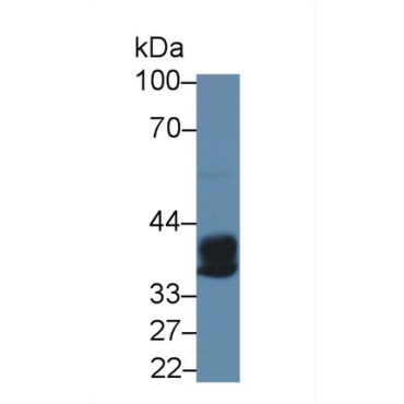 Carboxypeptidase A3 (CPA3) Human Polyclonal Antibody