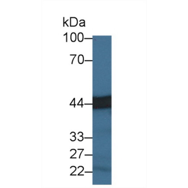 Carboxypeptidase A3 (CPA3) Mouse Polyclonal Antibody