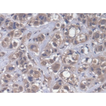 Cytoplasmic Polyadenylation Element Binding Protein 1 (CPEB1) Human Polyclonal Antibody
