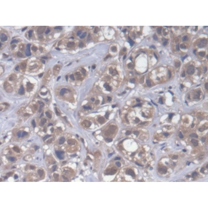 Cytoplasmic Polyadenylation Element Binding Protein 1 (CPEB1) Human Polyclonal Antibody
