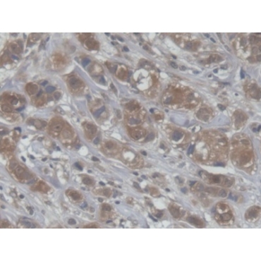 Cellular Retinoic Acid Binding Protein 1 (CRABP1) Human Polyclonal Antibody