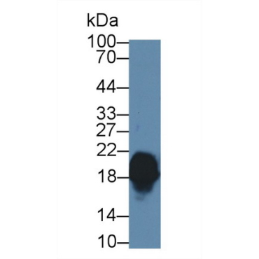 Complexin 1 (CPLX1) Human Polyclonal Antibody