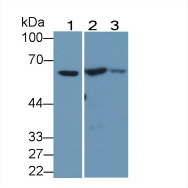 Carnitine Acetyltransferase (CRAT) Human Polyclonal Antibody