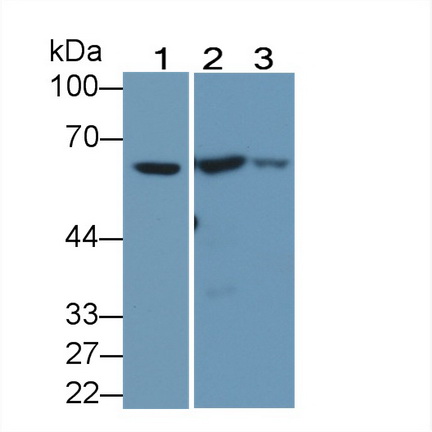 Carnitine Acetyltransferase (CRAT) Human Polyclonal Antibody