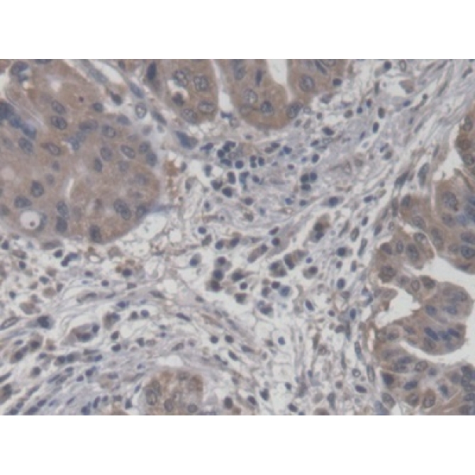 Carnitine-O-Octanoyltransferase (CORT) Human Polyclonal Antibody