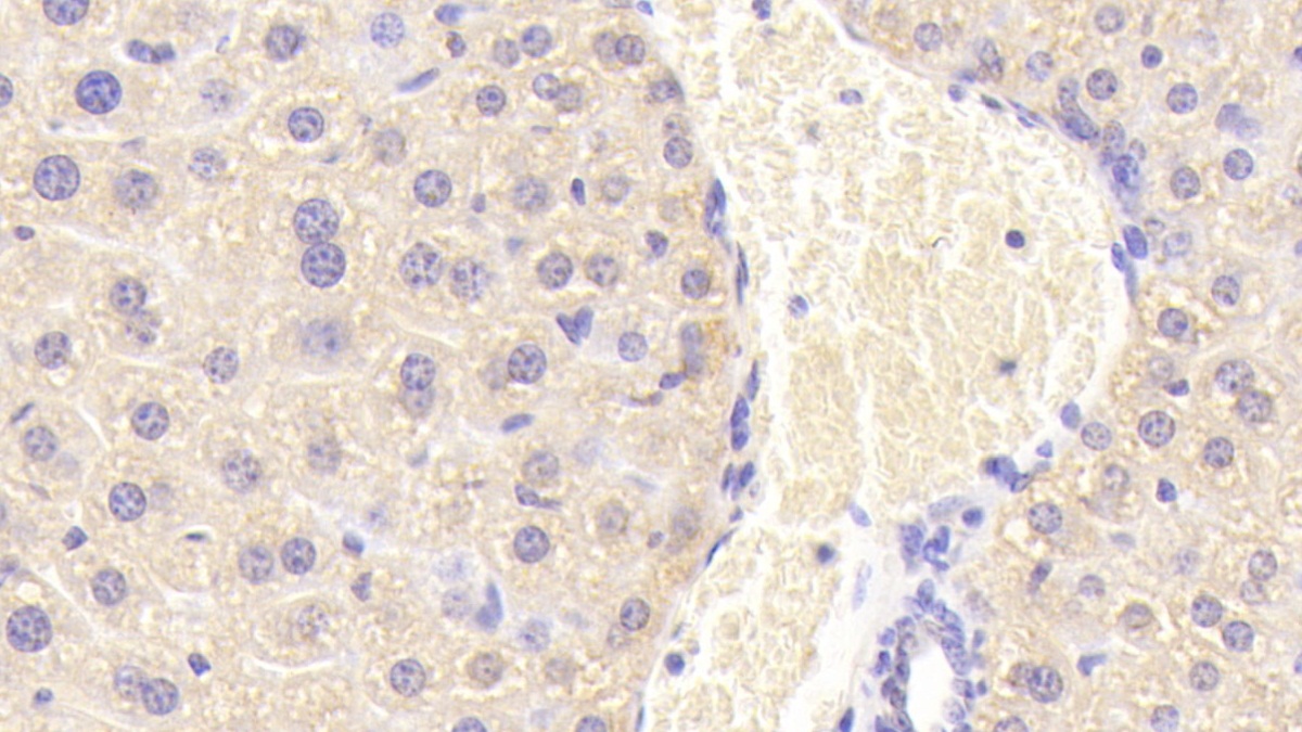 Carnitine-O-Octanoyltransferase (CORT) Mouse Polyclonal Antibody
