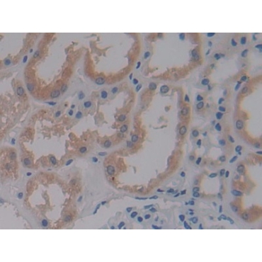 Cryptochrome 1 (CRY1) Human Polyclonal Antibody