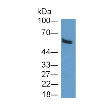 C-Terminal Binding Protein 1 (CTBP1) Human Polyclonal Antibody