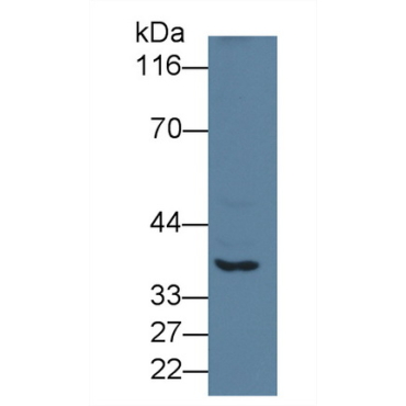 Cathepsin E (CTSE) Human Polyclonal Antibody