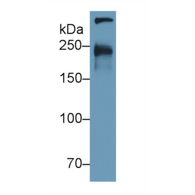 Cubilin (CUBN) Human Polyclonal Antibody