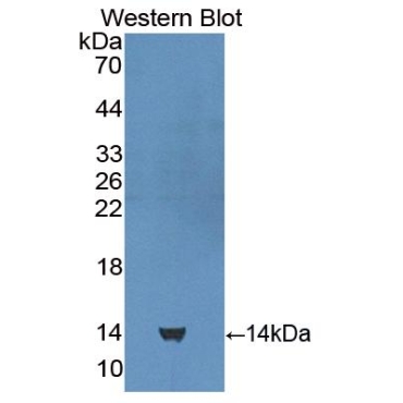 Cubilin (CUBN) Human Polyclonal Antibody