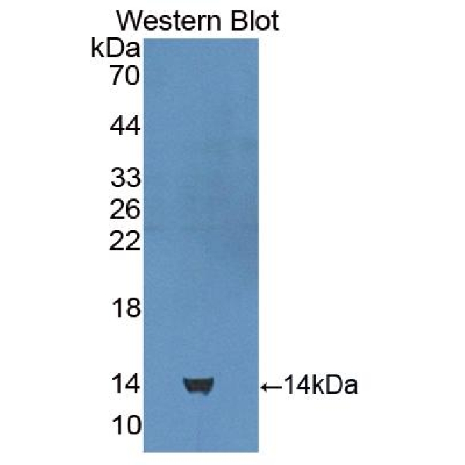 Cubilin (CUBN) Human Polyclonal Antibody