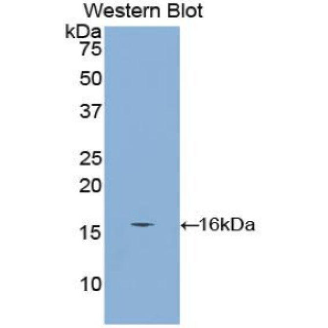Cubilin (CUBN) Mouse Polyclonal Antibody